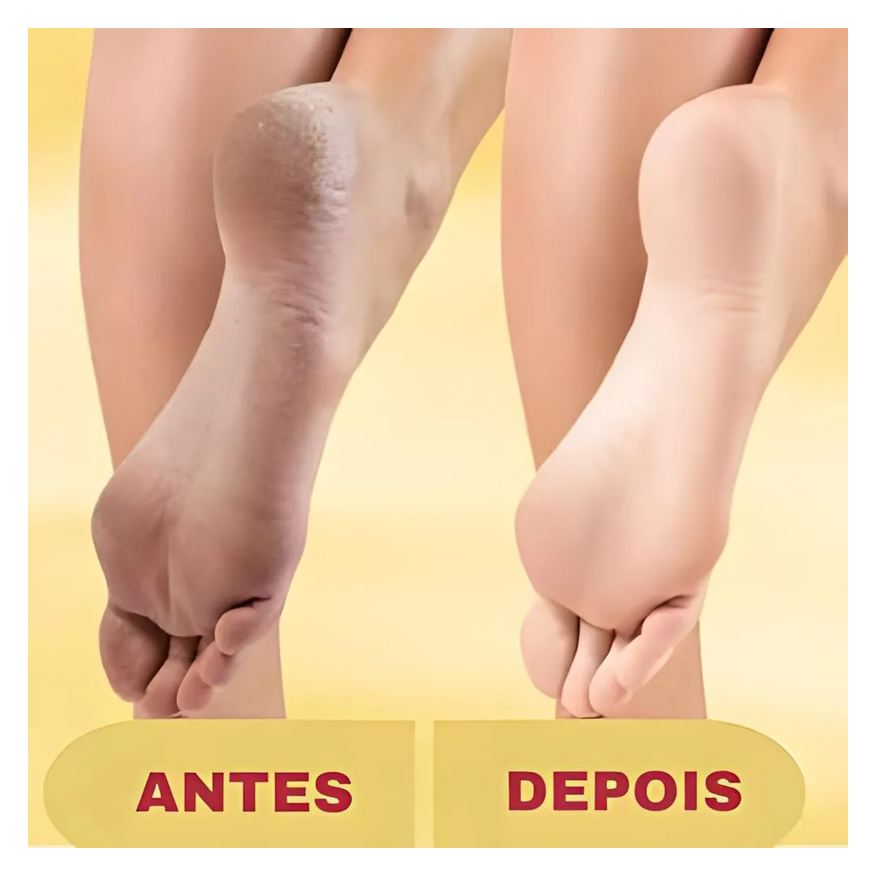 Elétrica Lixa Pés Pedicuro Removedor Calos E Rachaduras + Creme Esfoliante