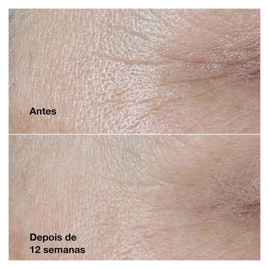 Antirrugas Creme Smart Clinical Repair 50ml