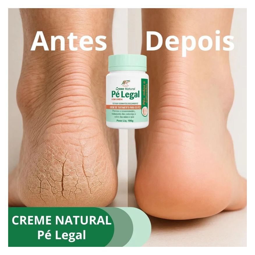 de Creme Uréia para Pés e Cotovelos Hidratação Intensa